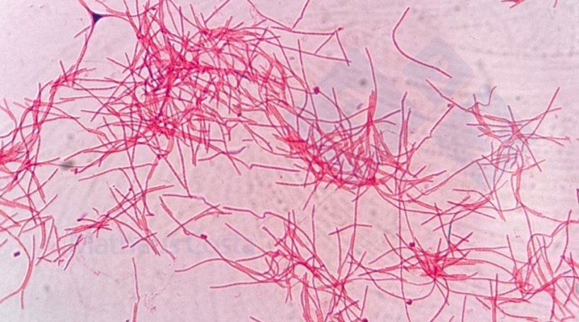 Figure 2. Fusobacterium necrophorum au microscope.
